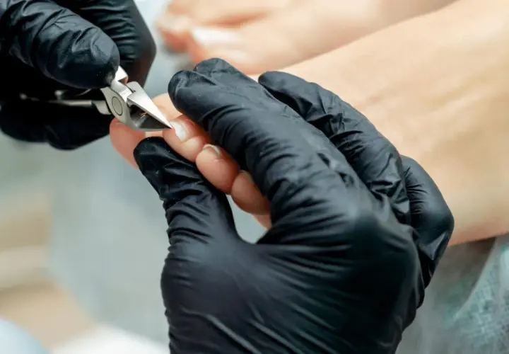 Dłoń w czarnej rękawiczce precyzyjnie wykonuje rekonstrukcję paznokcia u stopy za pomocą cążków.