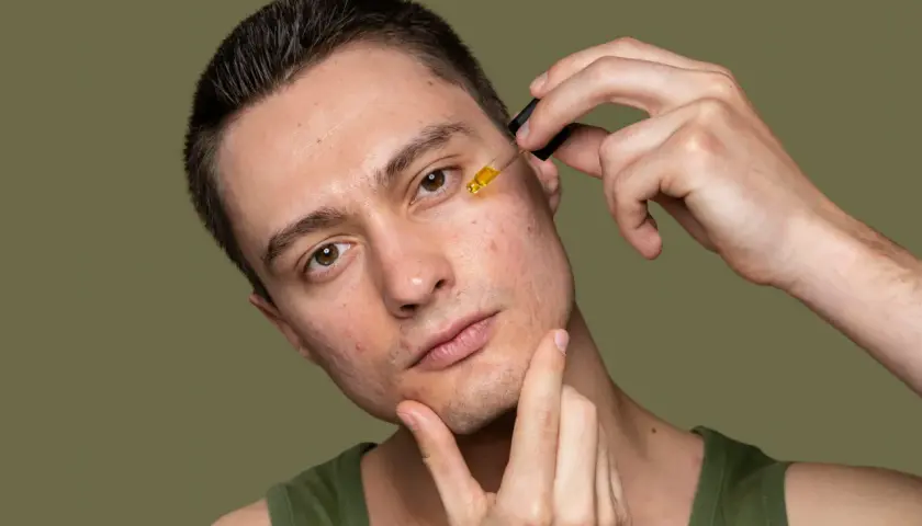 Mężczyzna aplikuje serum na twarz, walcząc z niedoskonałościami i myśląc o wyciskaniu wągrów.