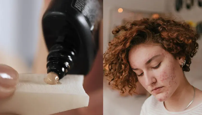 Jaki krem BB do cery trądzikowej, który naprawdę działa na skórę?