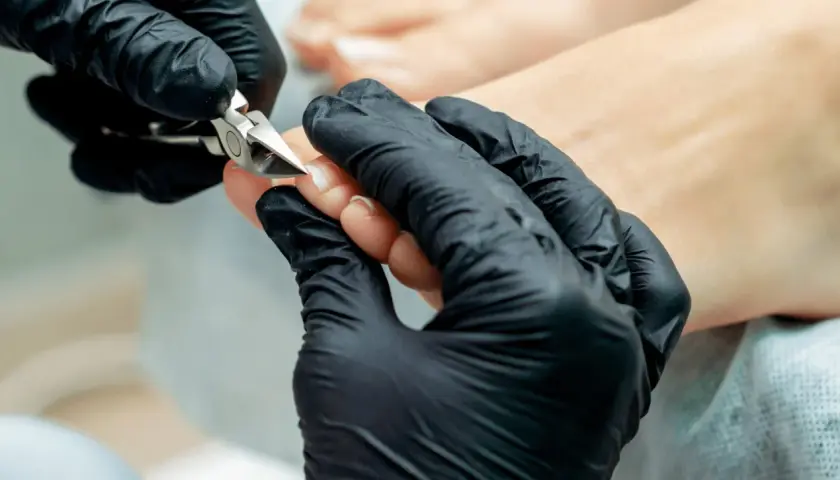 Dłoń w czarnej rękawiczce precyzyjnie wykonuje rekonstrukcję paznokcia u stopy za pomocą cążków.